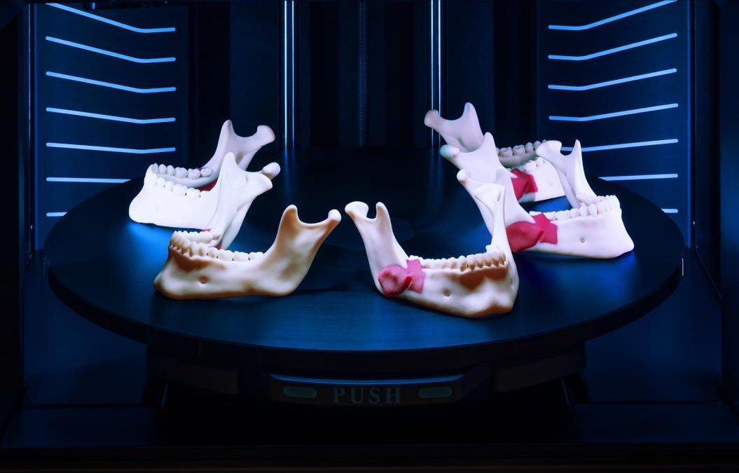 L’impression 3D Stratasys améliore la qualité de service des dentistes numériques