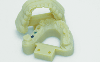 Vulcan Custom Dental trouve des solutions efficaces et viables avec l’impression 3D