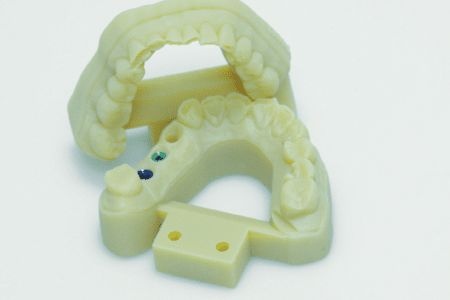 Vulcan Custom Dental trouve des solutions efficaces et viables avec l’impression 3D